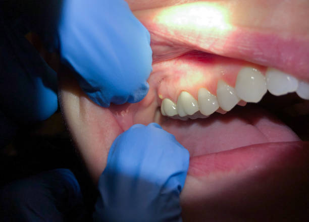 Best Dentist for Dental Trauma  in New Castle, DE